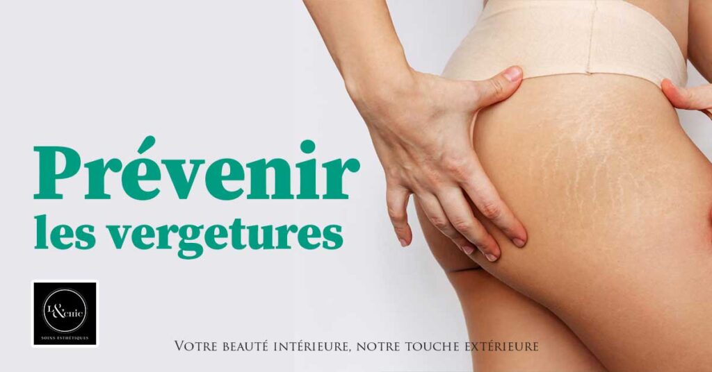 Traitement des vergetures : comprendre, prévenir et atténuer